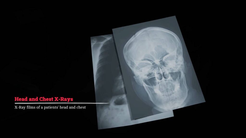 How to take the X-Rays in Silent Hill Townfall